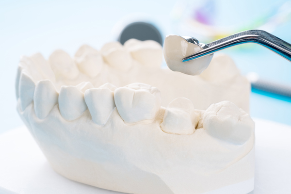 When Is Getting A Dental Crown Necessary?