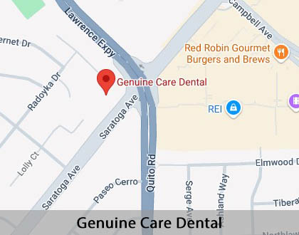 Map image for The Difference Between Dental Implants and Mini Dental Implants in Saratoga, CA