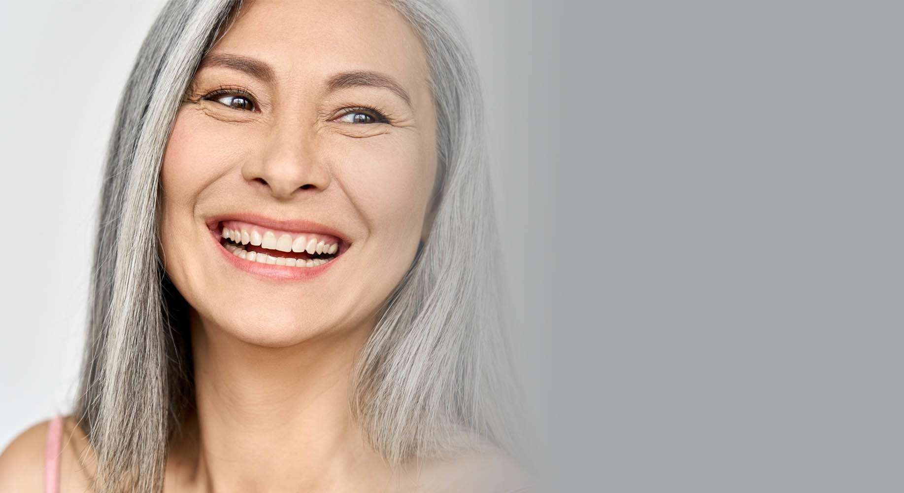 All-On-4 Dental Implants