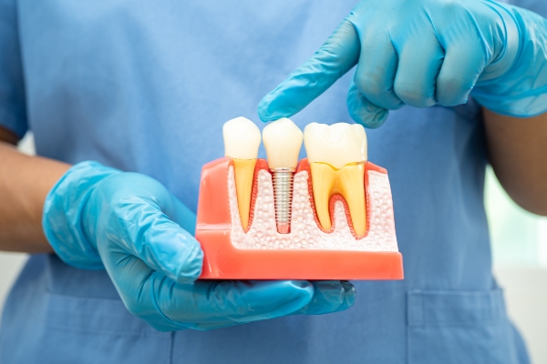 The Different Types Of Dental Implants