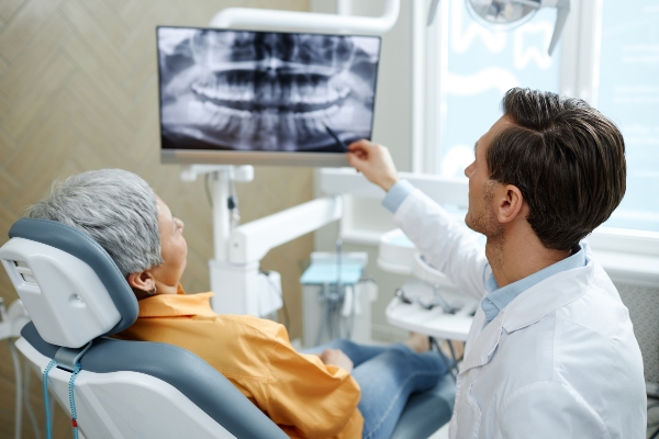 The Ultimate Guide To Receiving Dental Implants